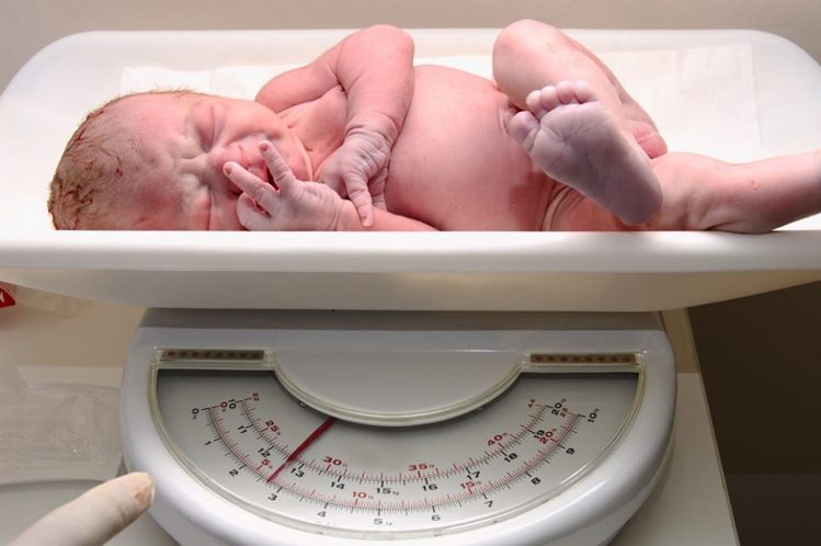 क्योँ जन्म के बाद नवजात शिशु का वजन घट गया why baby weight drops after birth